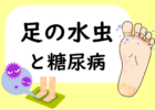 足の水虫と糖尿病